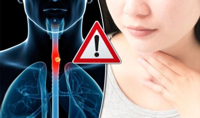 Esophageal Cancer Throat Cancer Warning Signs You Should Know.